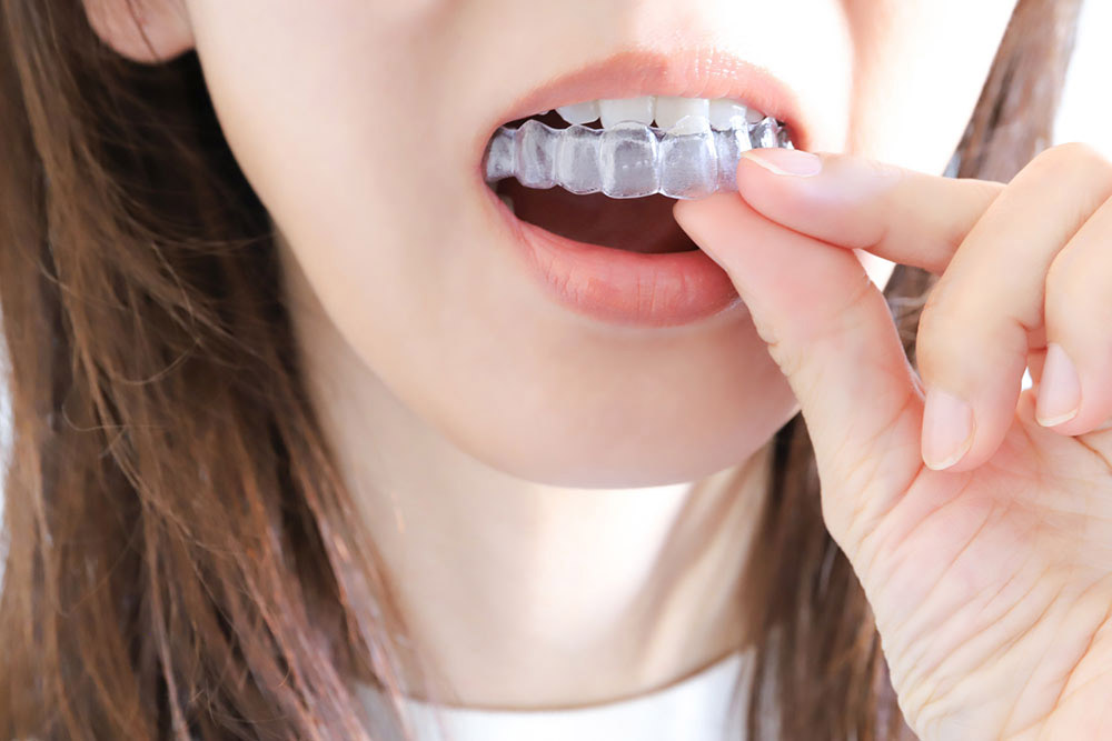 目立ちにくい矯正で、健康で美しい見た目に