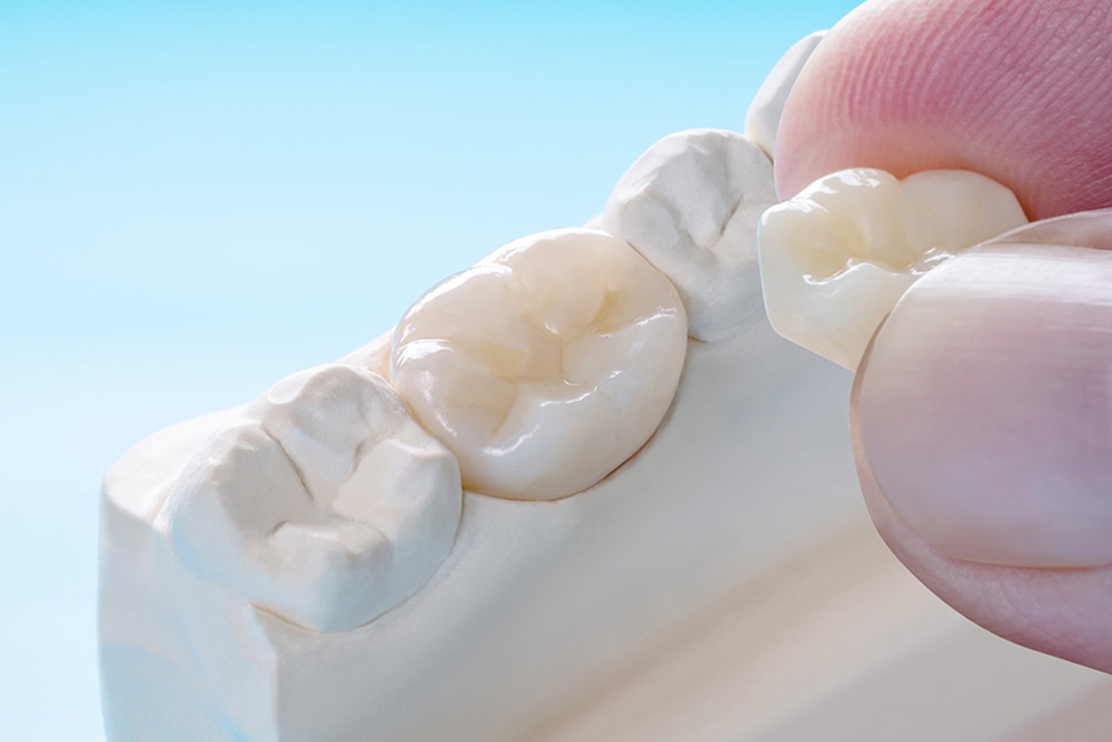 見た目と機能性を両立 審美治療