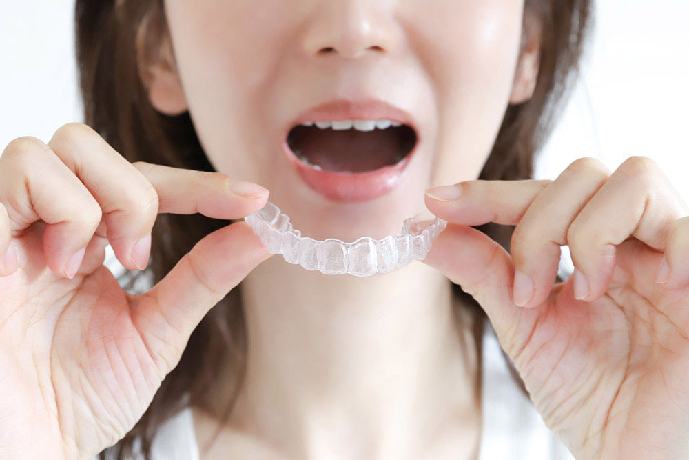 小児矯正（Ⅱ期治療）