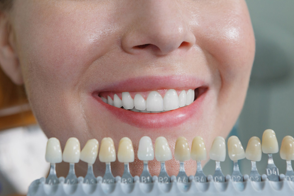 白く美しい歯で自信のある素敵な笑顔に