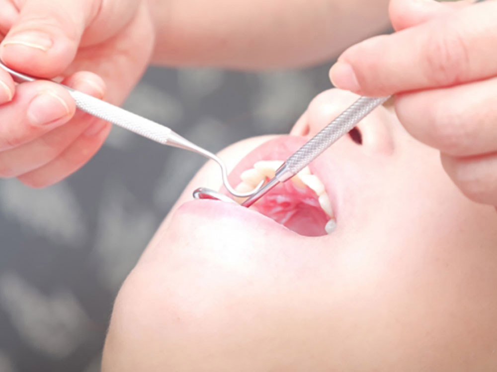 お口の状態をチェック