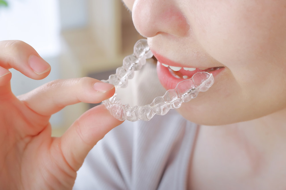 自宅でホワイトニング