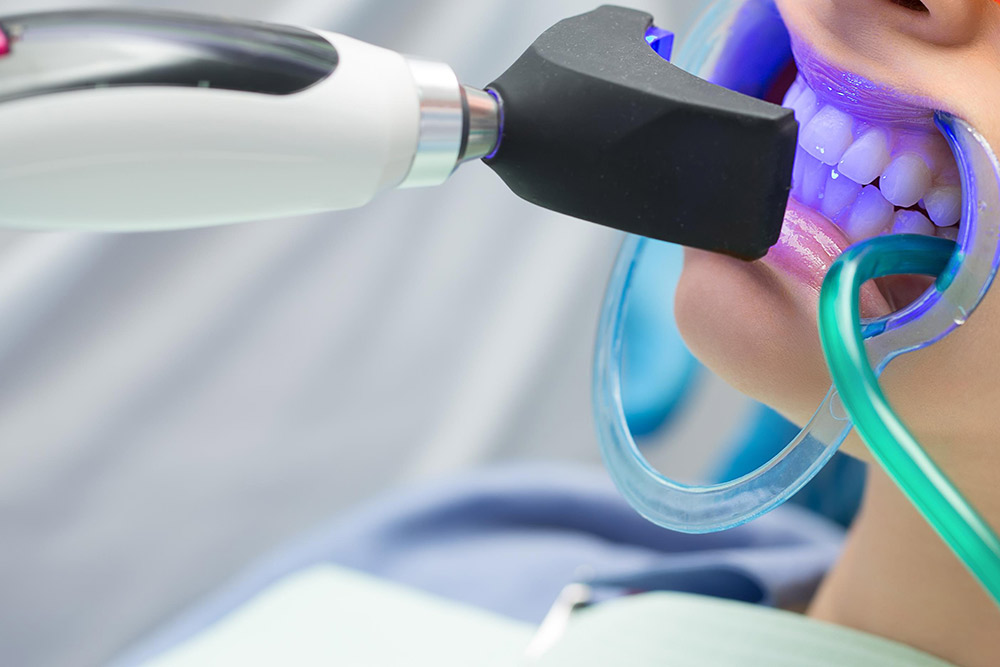 ホワイトニング剤を塗布しライト照射